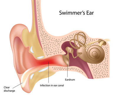 راه های درمان التهاب گوش