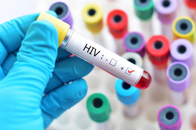 دانستنی‌های لازم درباره اچ‌آی‌وی