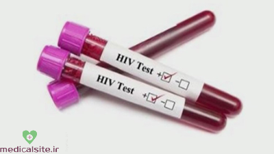  تفاوت ایدز و اچ آی وی, علائم اچ آی وی مثبت